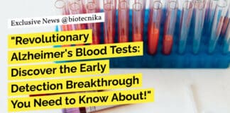 "Revolutionary Alzheimer's Blood Tests: Discover the Early Detection Breakthrough You Need to Know About!"